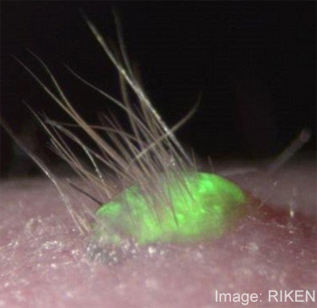 Japanese Scientists Learn How to Create Skin Cells That Will Grow Hair