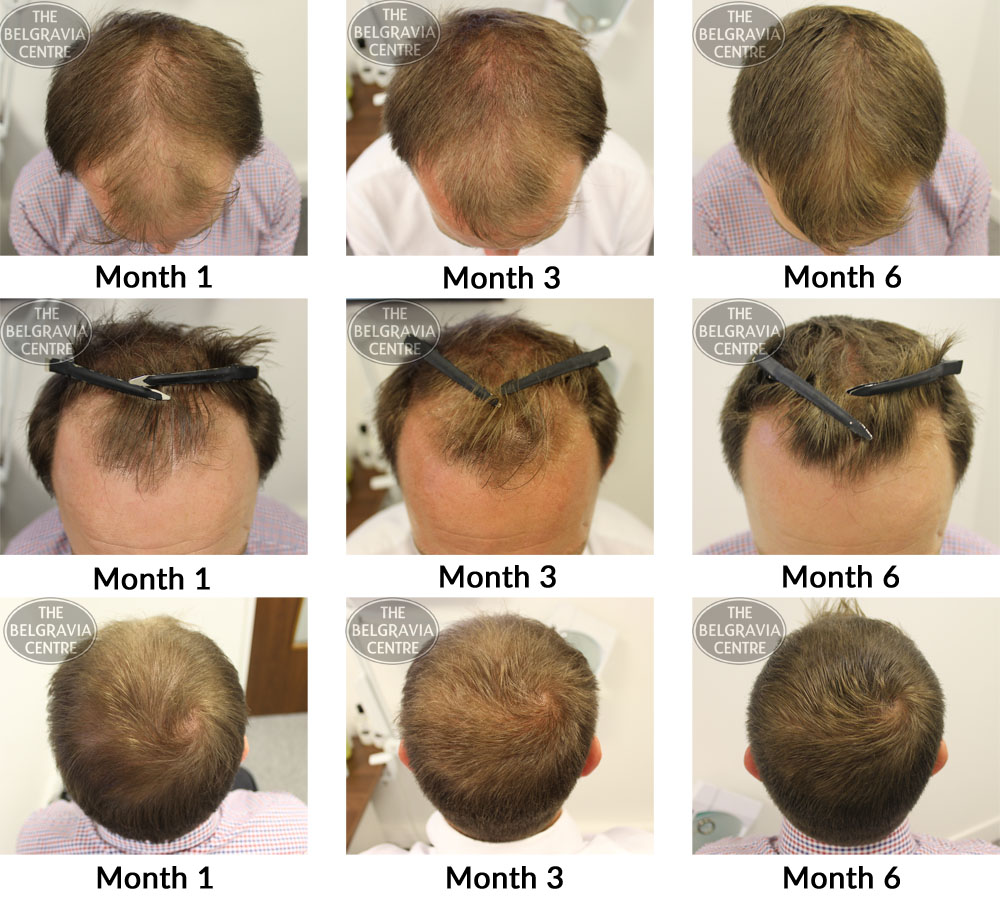 Overwhelmed with my results after 6 months