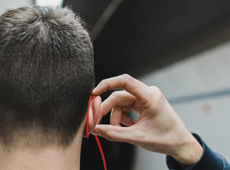 Experiencing Hair Loss From Temple Area and Nape' Experiencing Hair Loss From Temple Area and Nape'