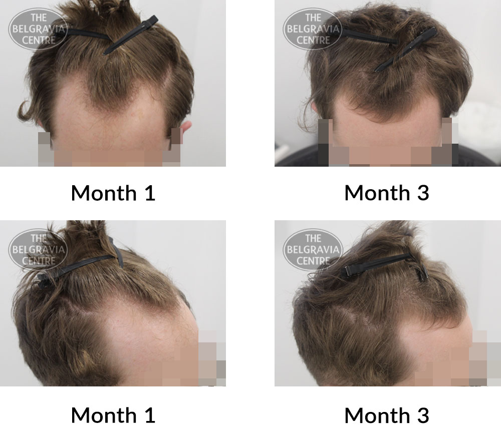 How to Grow Out Your Hair For Men  OnPointFresh