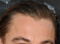 My Hairline is Thinning So Why is My Widow's Peak Still Growing?' My Hairline is Thinning So Why is My Widow's Peak Still Growing?'
