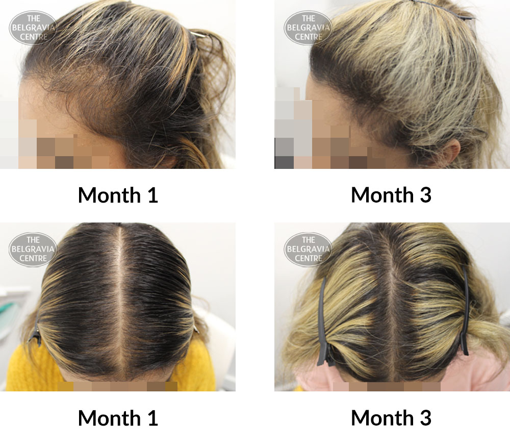 I am really happy with the progress in only 3 months