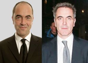 James Nesbitt before and after his FUT hair transplant