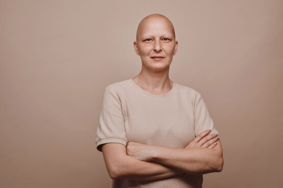 Alopecia Universalis (for Hair Loss Conditions Page Belgraviacentre.com)