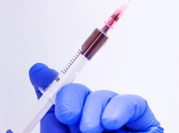 Syringe Injection PRP Adipose