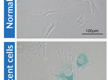 Normal Cells v Senescent Cells