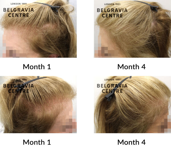 diffuse thinning the belgravia centre 451089