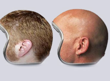 Hair Loss Helmets Help Bikers Disguise Balding