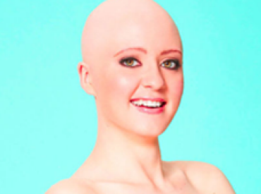 Woman Refuses To Be Defind By Her Baldness From Alopecia Hair Loss