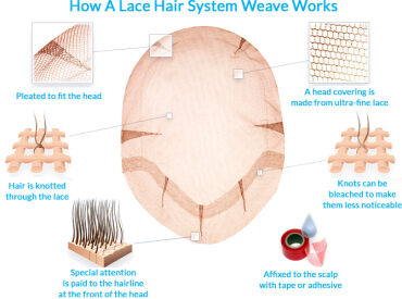 How A Lace Hair System Works The Belgravia Centre Hair Loss Blog1