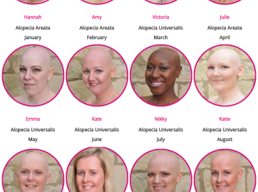 Pretty Bald Alopecia Calendar Girls 2014 Hair Loss Awareness and Charity Fundraising