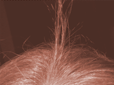 Thin Hair Caused by Hair Breakage