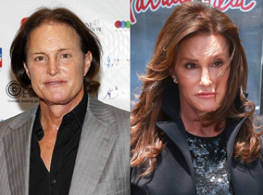 Did Caitlyn Jenner Have a Hair Transplant