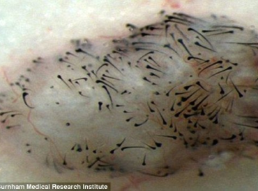 Human Hair Growth On Leg Of Adult Mouse After Stem Cell Research Into Hair Loss Treatments Has Breakthrough Belgravia Centre Blog