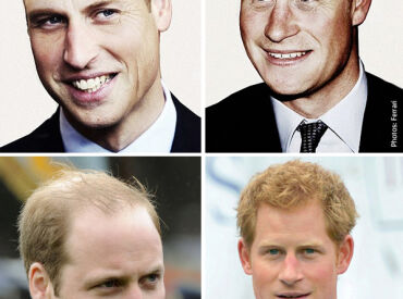Prince William and Prince Harry Thought to Both Be Bald by Age 50