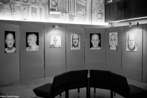 The Alopecia Project Photography Exhibition by Daniel Regan1