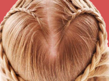 Hairstyles That Can Cause Hair Loss