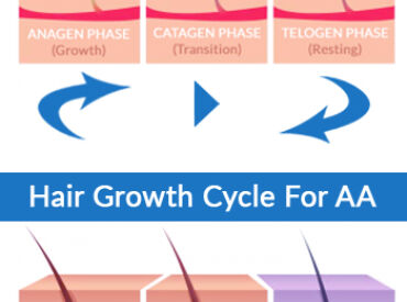 Normal Hair Growth Cycle versus Hair Growth in Alopecia Areata