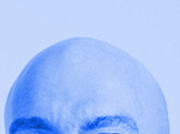 Scalp Conditions Bald Head