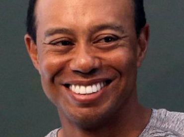 Tiger Woods Thinning Hair Receding Hairline