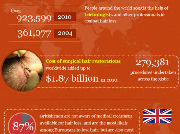 infographic hair loss