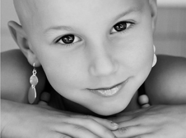 Alopecia in kids1
