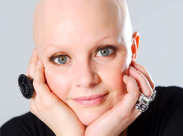 Gail Porter says Alopecia made her lonely