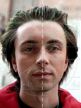 uneven hairline receding hairline facial symmetry male pattern baldness
