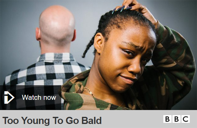 Too Young To Go Bald BBC Hair Loss Documentary