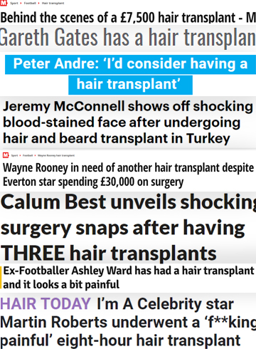Footballer Celebrity Hair Transplant Headlines