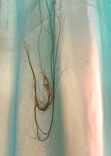 Losing hair in the shower - hair loss shedding