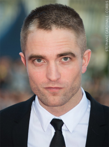 Did Robert Pattinson Have Alopecia Areata?