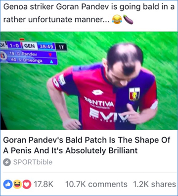 Footballer Goran Pandev male hair loss on top unfortunate pattern