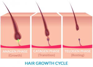 What is Anagen Effluvium Hair Loss?