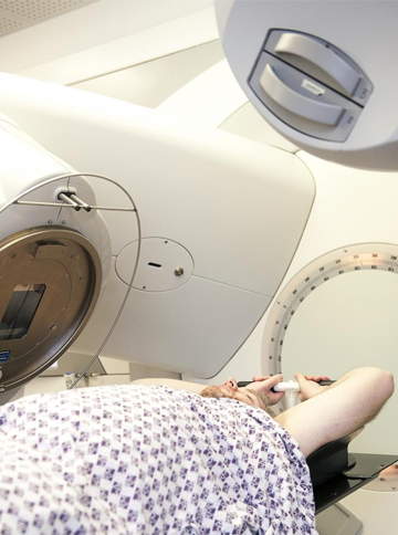 Radiotherapy hair loss cancer treatment