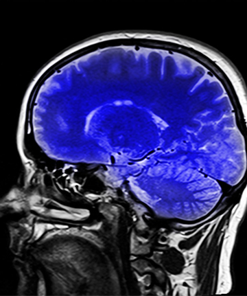 Brain Head X-Ray