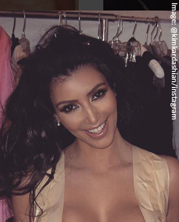 Kim Kardashian Old Hairline