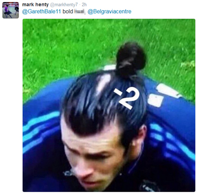 Gareth Bale Receding Hairline Bald Patch Tweet
