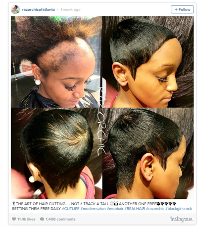Hairstylist 'Frees' Woman With Severe Traction Alopecia Hair Loss