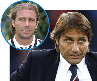 Chelsea Manager Antonio Conte with Thinning Hair on Top