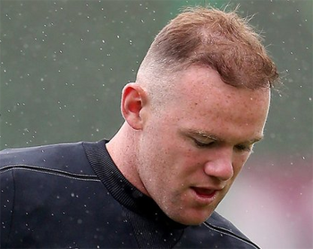 Wayne Rooney Has Helped to Boost the Popularity of Hair Transplants