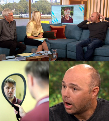 Karl Pilkington Discusses Getting his Hair Back on This Morning