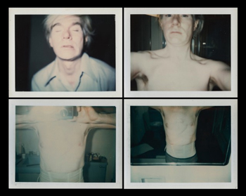 Andy Warhol May Have Had Alopecia Totalis