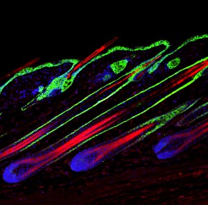 Immunoflorscent staining of hair follicles - Photo by Yuan and colleagues