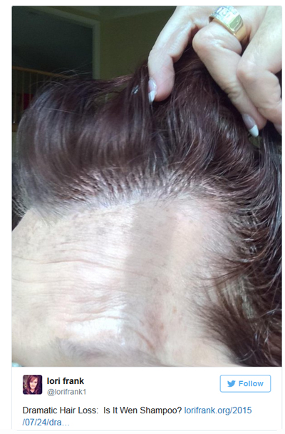 Twitter User Demonstrates Hair Loss Which She Thinks May Be From Using Wen Products