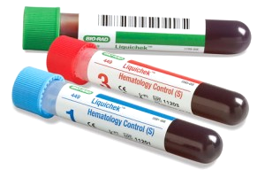 Blood Tests are the Most Common Way to Establish Your DHT Levels