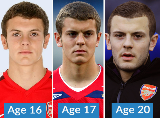 These Pictures Show Arsenal Footballer Jack Wilshere's Maturing Hairline