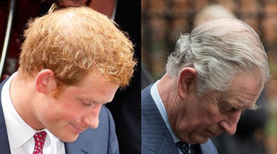 Prince Harry Pictured with a Thinning Crown in 2013 - Was it Passed on By Dad, Prince Charles?