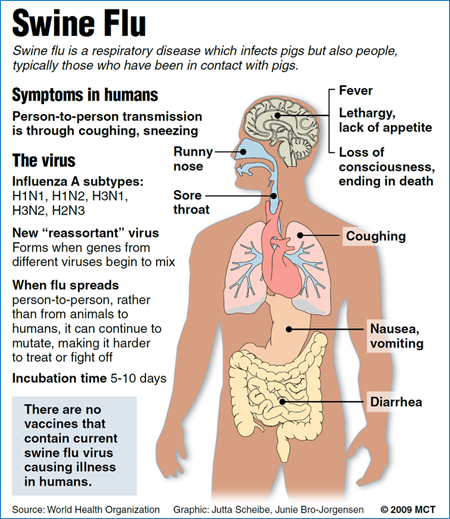 Symptoms of Swine Flu According to the World Health Organization - 2009