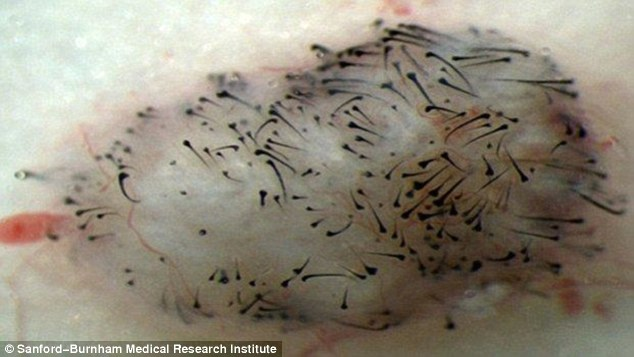 Human Hair Growth On Leg Of Adult Mouse After Stem Cell Research Into Hair Loss Treatments Has Breakthrough